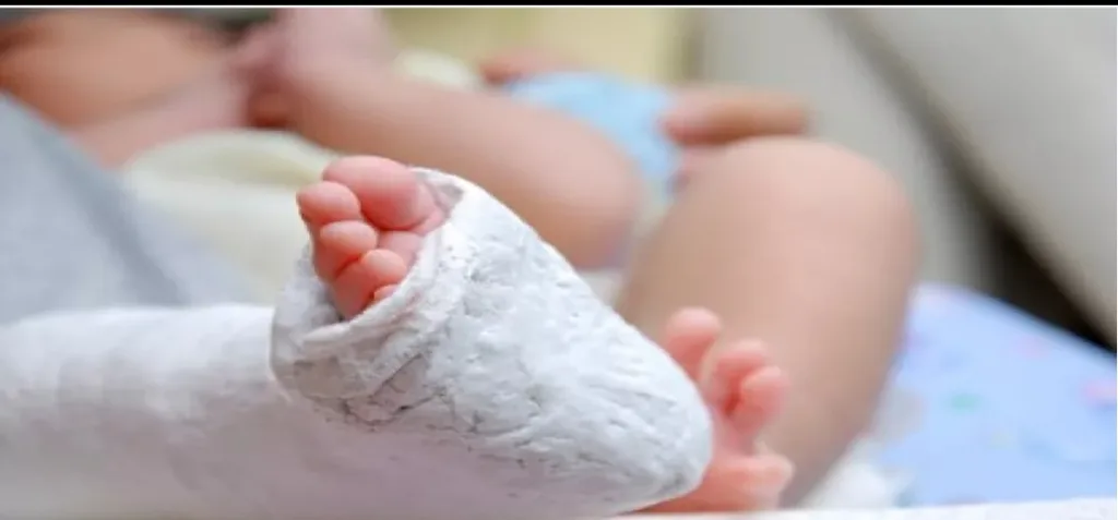كسرت قدمها وأدخلت لغرفة العمليات فخرجت جثة ..تفاصيل صادمة